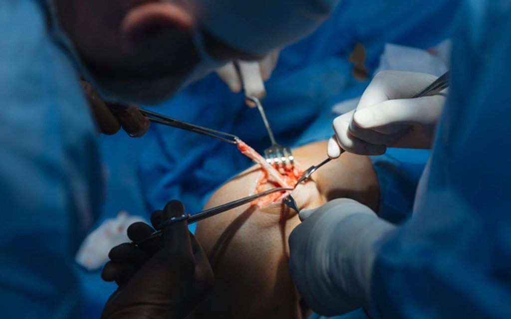 knee surgery